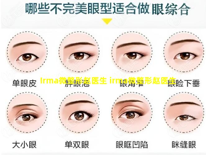 Irma微整形赵医生 irma微整形赵医生